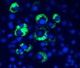 Immunofluorescence of adipocytes differentiating in a tissue culture dish. Lipid droplets are stained green with Bodipy and nuclei are stained blue with DAPI.