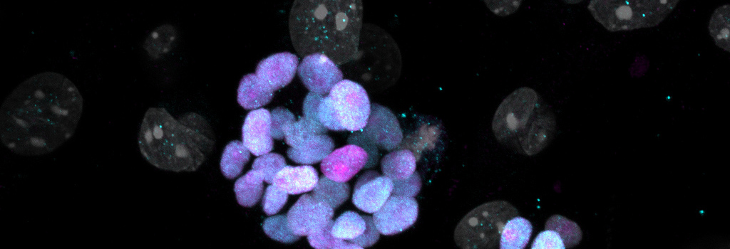 ImageJ=1.53tunit=micron