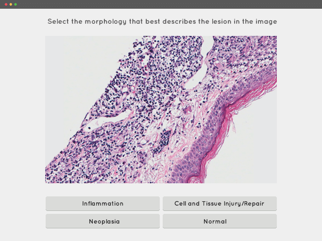 plm-histopathology