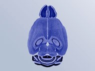 brain_pic