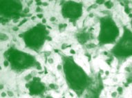 cells_pic