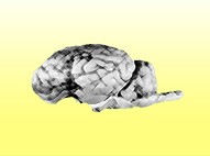 yellow_brain_pic
