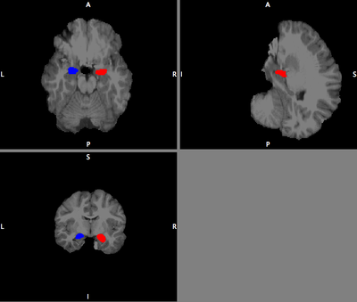 smri_pic