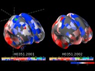 Brain Awareness Week