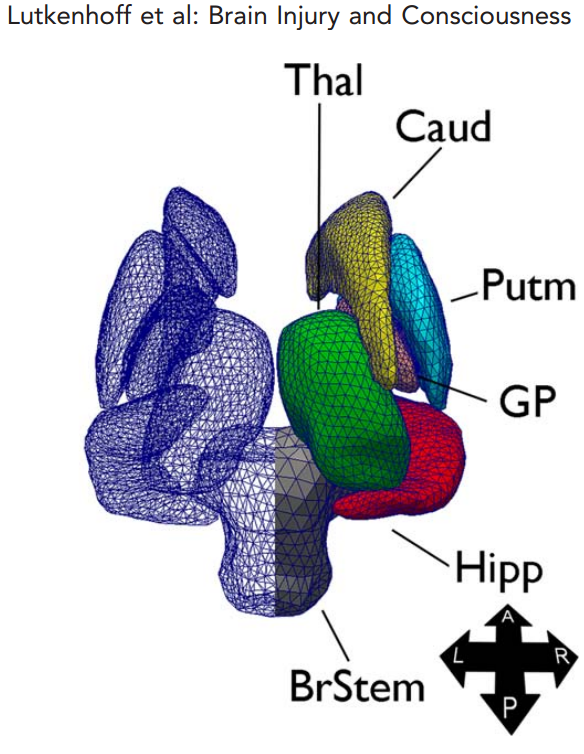 Lutkenhoff_SubcorticalAtrophy